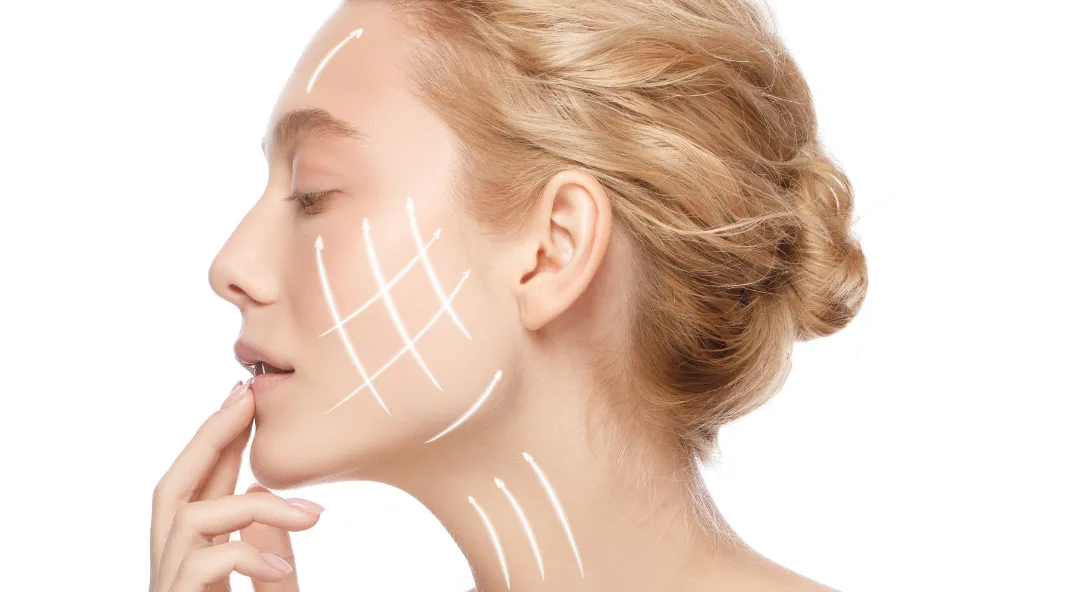 óvalo facial sin cirugía en Clinica Baños Málaga