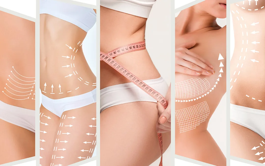 Cómo elegir el mejor tratamiento corporal según tu cuerpo