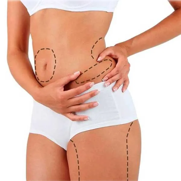 Hifu en Málaga - centro de estética avanzada málaga - clinica baños