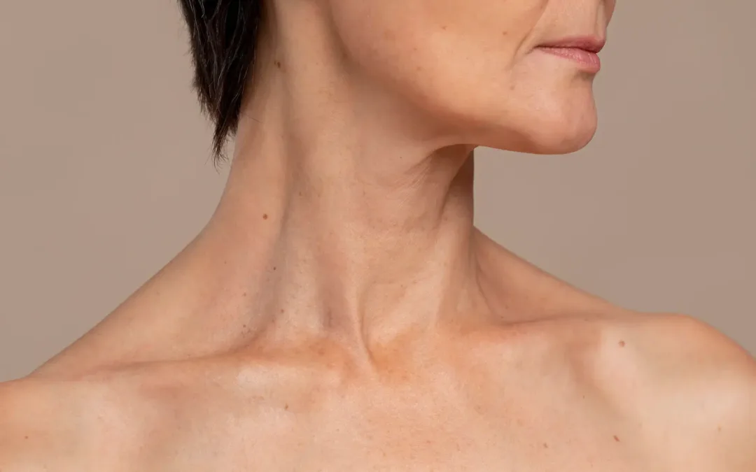 flacidez facial en mandíbula, cuello y escote