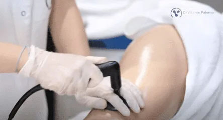 postoperatoria en Málaga con INDIBA®