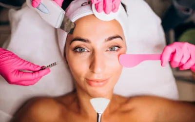 Peeling químico vs enzimático